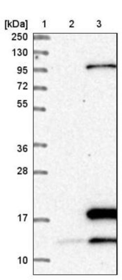 POLR3K Antibody, Novus Biologicals 0.1mL; Unlabeled:Antibodies, Polyclonal