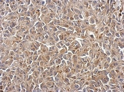 Polycystin 2 Antibody, Novus Biologicals™