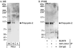 Polycystin 2 Antibody, Novus Biologicals 0.1mL; Unlabeled:Antibodies, Polyclonal