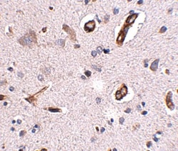 Polypeptide GalNac Transferase 10/GALNT10 Antibody - BSA Free, Novus Biologicals