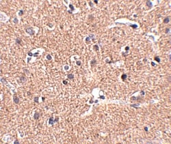 Polypeptide GalNac Transferase 10/GALNT10 Antibody - BSA Free, Novus Biologicals
