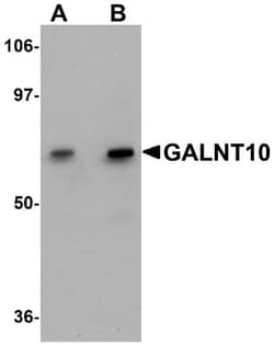 Polypeptide GalNac Transferase 10/GALNT10 Antibody - BSA Free, Novus Biologicals