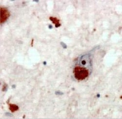 Poly-Ubiquitin Antibody (HWA4C4) - K63 Linkage, Novus Biologicals 0.05mL;