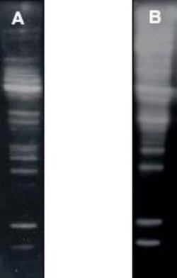 Poly-Ubiquitin Antibody (HWA4C4) - K63 Linkage, Novus Biologicals 0.05mL;