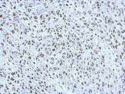 POM121 Antibody, Novus Biologicals 0.1mL; Unlabeled:Antibodies, Polyclonal