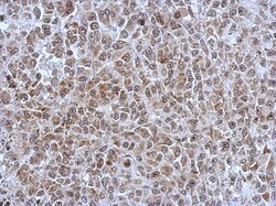 POM121 Antibody, Novus Biologicals 0.1mL; Unlabeled:Antibodies, Polyclonal