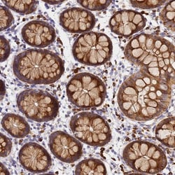 POM121 Antibody, Novus Biologicals:Antibodies:Primary Antibodies