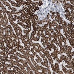 POM121L12 Antibody, Novus Biologicals:Antibodies:Primary Antibodies