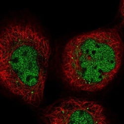 POM121L2 Antibody, Novus Biologicals 0.1mL; Unlabeled:Antibodies, Polyclonal