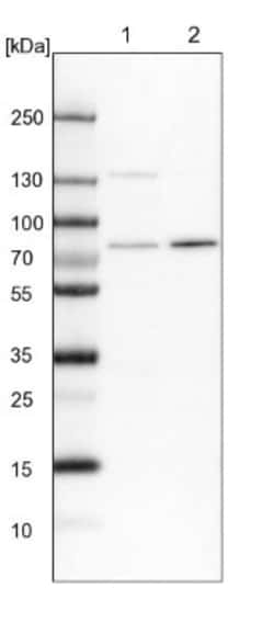 POMT2 Antibody, Novus Biologicals 0.1 mL | Buy Online | Novus Biologicals | Fisher Scientific