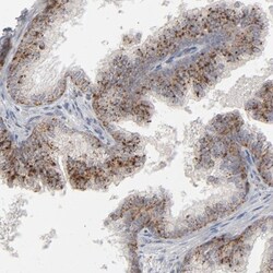 POMT2 Antibody, Novus Biologicals 0.1 mL | Buy Online | Novus Biologicals | Fisher Scientific