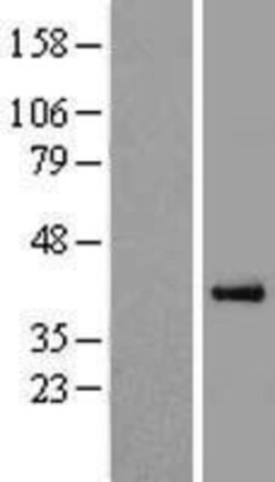 Novus Biologicals™ PON3 Overexpression Lysate