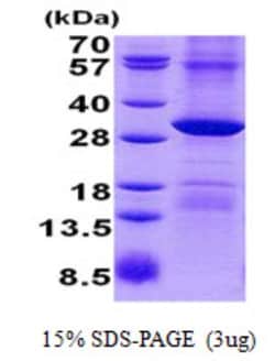 Novus Biologicals&trade;&nbsp;Recombinant Human POP4 His Protein