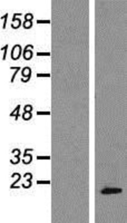 Novus Biologicals&trade;&nbsp;POP7 Overexpression Lysate