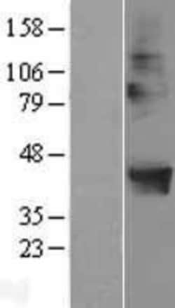 Novus Biologicals™ POPDC2 Overexpression Lysate