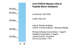 PORCN Antibody, Novus Biologicals 0.05mg; Unlabeled:Antibodies, Polyclonal