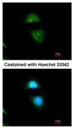 POR/Cytochrome P450 Reductase Antibody, Novus Biologicals 0.1mL; Unlabeled:Antibodies,