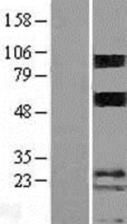 Novus Biologicals™ Porimin Overexpression Lysate