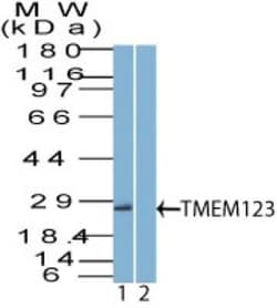 Porimin Antibody, Novus Biologicals 0.1 mg | Buy Online | Novus Biologicals | Fisher Scientific
