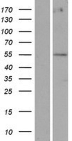 Novus Biologicals™ POTEA Overexpression Lysate