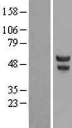 Novus Biologicals&trade;&nbsp;POU2F3 Overexpression Lysate