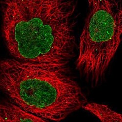POU6F1 Antibody, Novus Biologicals 25 &mu;L, Unlabeled:Antibodies, Polyclonal