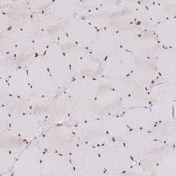 POU6F1 Antibody, Novus Biologicals 25 &mu;L, Unlabeled:Antibodies, Polyclonal