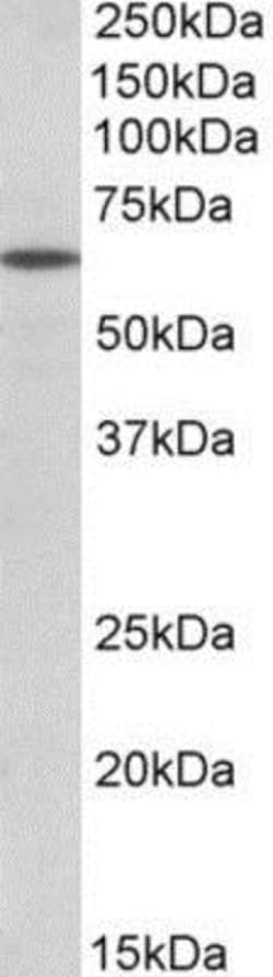 POU6F2 Antibody, Novus Biologicals 0.1mg; Unlabeled:Antibodies, Polyclonal