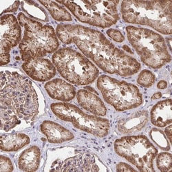 PP1 alpha/PPP1A Antibody, Novus Biologicals 0.1mL; Unlabeled:Antibodies,