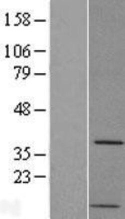 Novus Biologicals PP2A alpha Overexpression Lysate 0.1mg:Protein Analysis