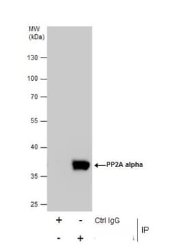 PP2A alpha Antibody, Novus Biologicals 0.1mL; Unlabeled:Antibodies, Polyclonal