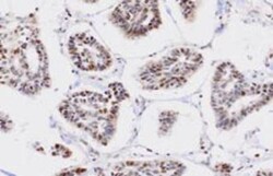 PP2C gamma/PPM1G Antibody (k1G6) - BSA Free, Novus Biologicals 0.1mL; Unlabeled:Antibodies,
