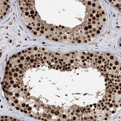 PP2C gamma/PPM1G Antibody, Novus Biologicals:Antibodies:Primary Antibodies