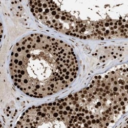 PP2C gamma/PPM1G Antibody, Novus Biologicals 0.1mL; Unlabeled:Antibodies,