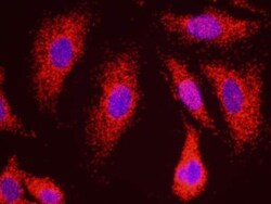 PP5 Antibody, Novus Biologicals 0.1mL; Unlabeled:Antibodies, Polyclonal