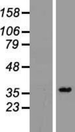 Novus Biologicals&trade;&nbsp;PPA2 Overexpression Lysate