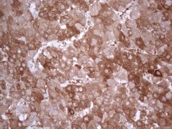 PPA2 Antibody (OTI7C1), Novus Biologicals 0.1mL; Unlabeled:Antibodies,
