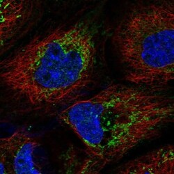 PPA2 Antibody, Novus Biologicals 0.1mL; Unlabeled:Antibodies, Polyclonal