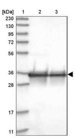 PPA2 Antibody, Novus Biologicals 0.1mL; Unlabeled:Antibodies, Polyclonal