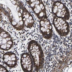 P2Y11/P2RY11 Antibody, Novus Biologicals 0.1mL; Unlabeled:Antibodies, Polyclonal