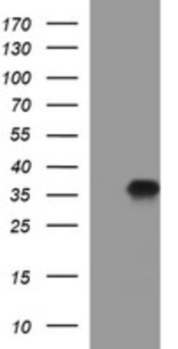 PPAP2A Antibody (OTI1H4), Novus Biologicals 0.1mL; Unlabeled:Antibodies,