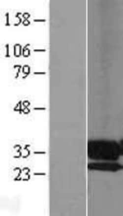 Novus Biologicals&trade;&nbsp;PPAP2A Overexpression Lysate