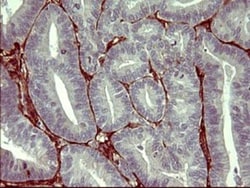 PPAP2A Antibody (OTI1H4), Novus Biologicals 0.1mL; Unlabeled:Antibodies,