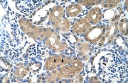 PPAP2A Antibody, Novus Biologicals 0.1mg; Unlabeled:Antibodies, Polyclonal