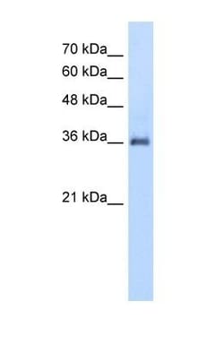 PPAP2A Antibody, Novus Biologicals 0.1mg; Unlabeled:Antibodies, Polyclonal