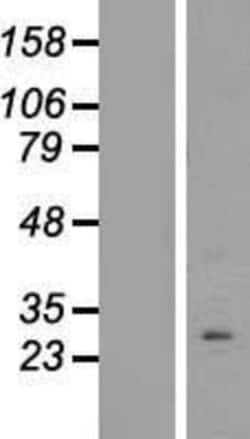 Novus Biologicals&trade;&nbsp;PPAPDC1B/DPPL1 Overexpression Lysate