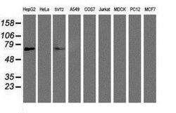 PPAR alpha/NR1C1 Antibody (OTI1E8), Novus Biologicals 0.1mL; Unlabeled:Antibodies,