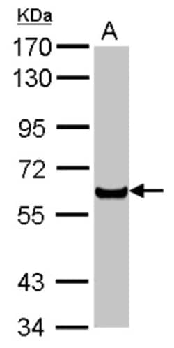 PPAR alpha/NR1C1 Antibody, Novus Biologicals 0.1 mL | Buy Online | Novus Biologicals | Fisher Scientific