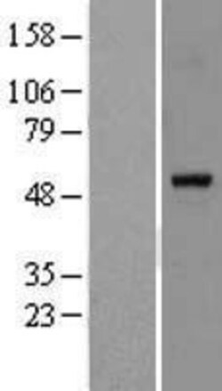 Novus Biologicals&trade;&nbsp;PPAR alpha/NR1C1 Overexpression Lysate