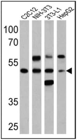 PPAR alpha/NR1C1, p Ser12 Antibody, Novus Biologicals 0.025 mg | Buy Online | Novus Biologicals | Fisher Scientific